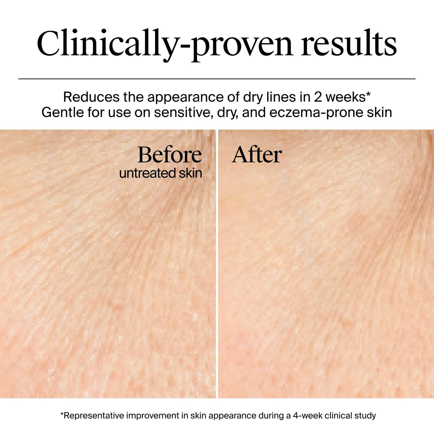 NEUTROGENA HYDRO BOOST GEL CREAM 50ML